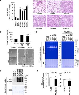 Dissection of the signal transduction machinery responsible for the lysyl oxidase-like 4-mediated increase in invasive motility in triple-negative breast cancer cells: mechanistic insight into the integrin-β1-NF-κB-MMP9 axis